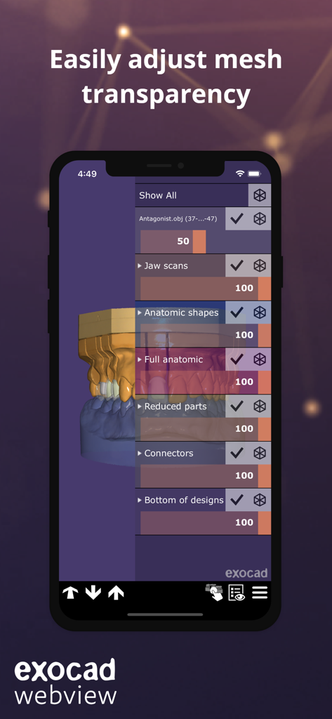 Mobile interface of exocad webview app showing transparency sliders for various dental 3D mesh layers