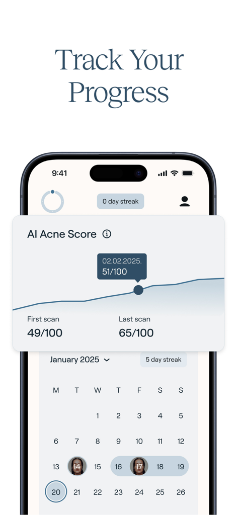 Nolla Acne - Nolla Acne app interface showing AI acne score graph and a daily progress calendar