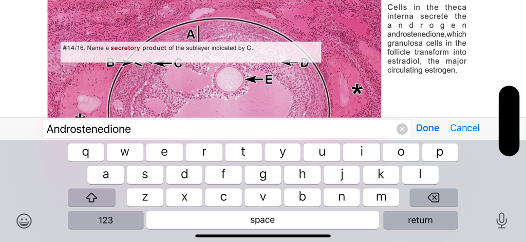 Histo! - Eine Histologie-Testfrage in der Histo-App mit einem beschrifteten Gewebepräparat und Tastatureingabe