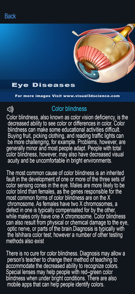 Educational screen about color blindness featuring a 3D human eye model and detailed medical text in the My Eye Anatomy app