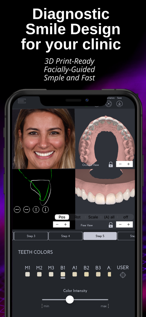 SmileFy TNG - Interfaz de la aplicación SmileFy TNG que muestra herramientas de diseño de sonrisas 3D y selección de color de dientes