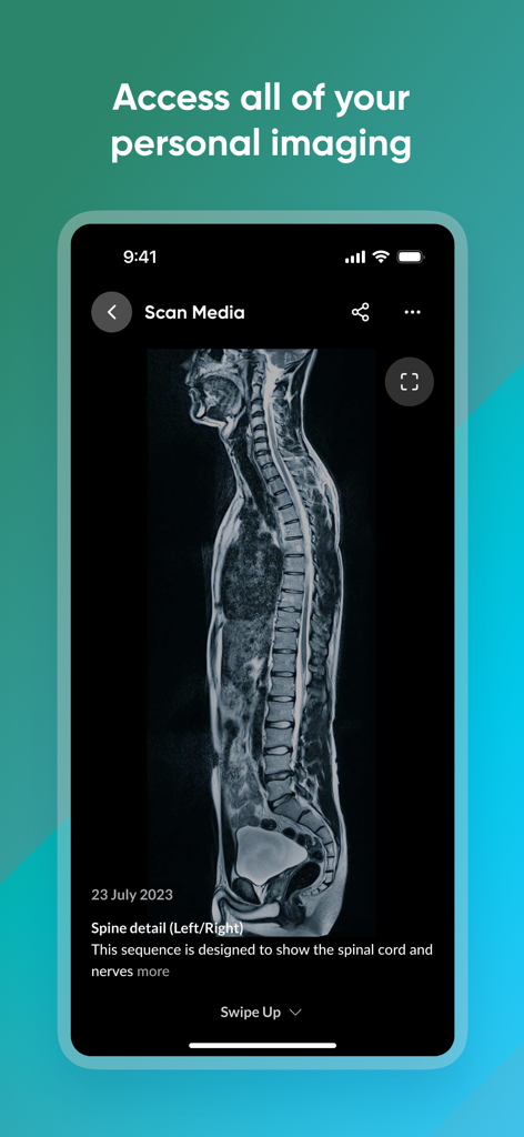 Mobile screen showing a detailed MRI scan of a human spine within the Prenuvo app interface.