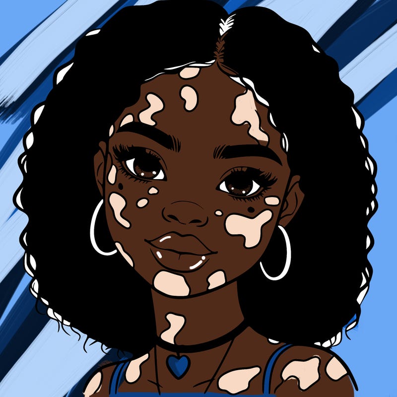 bleautiful black girl with vitiligo