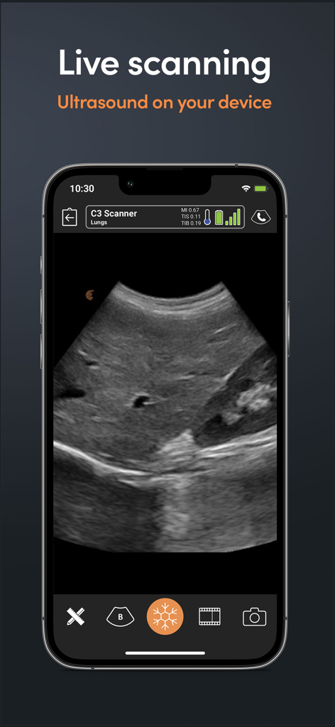 Écran d'iPhone affichant une échographie pulmonaire en direct via l'interface de l'application Clarius