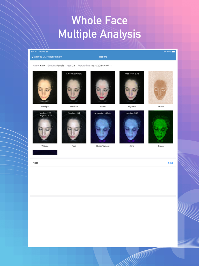 iPad screen displaying a Meicet skin analysis report with multiple facial diagnostic filters