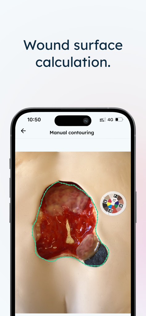 Pixacare - Pixacare app manual contouring tool for medical wound surface calculation