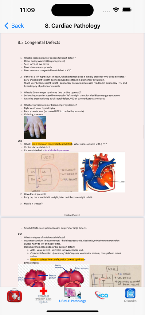 USMLE STEP 1 QUESTION BANK - Detailed cardiac pathology study notes and heart diagrams for medical student exam preparation