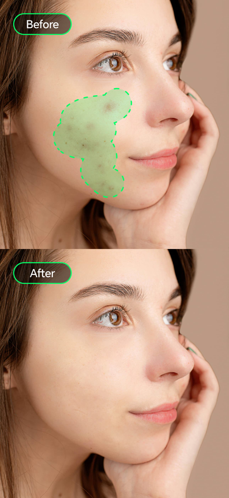 Retouch AI:Pimple Remover - Before and after comparison of skin retouching and pimple removal on a woman face
