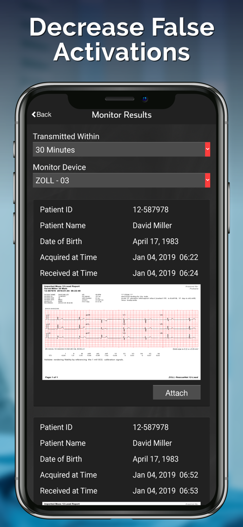 Pulsara: Medical Communication - Pulsara app screen showing patient monitor results with an attached ECG report for streamlined emergency coordination