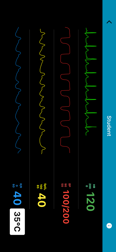 Simman - Ein medizinischer Simulationsmonitor in der Simman-App, der die Vitalwerte des Patienten anzeigt, einschließlich Herzfrequenz, Blutdruck, Sauerstoffsättigung und Atemfrequenz für das Studententraining.