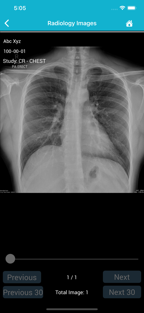 Family Hifazat - Family Hifazat app displaying a digital chest x-ray within the radiology images section.