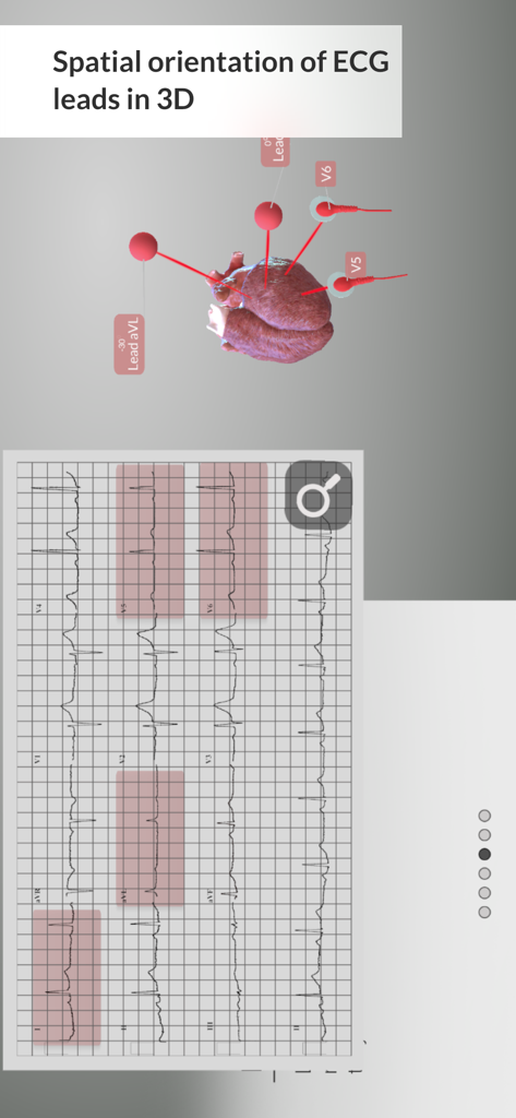 Spatial orientation of 3D ECG leads on a heart model with an EKG tracing