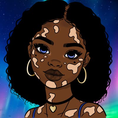 bleautiful black girl with vitiligo
