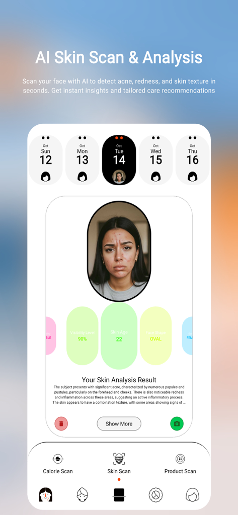 Oberfläche der Acnetic-App, die KI-Hautscan-Ergebnisse mit Akneerkennung und Hautalter-Metriken anzeigt.