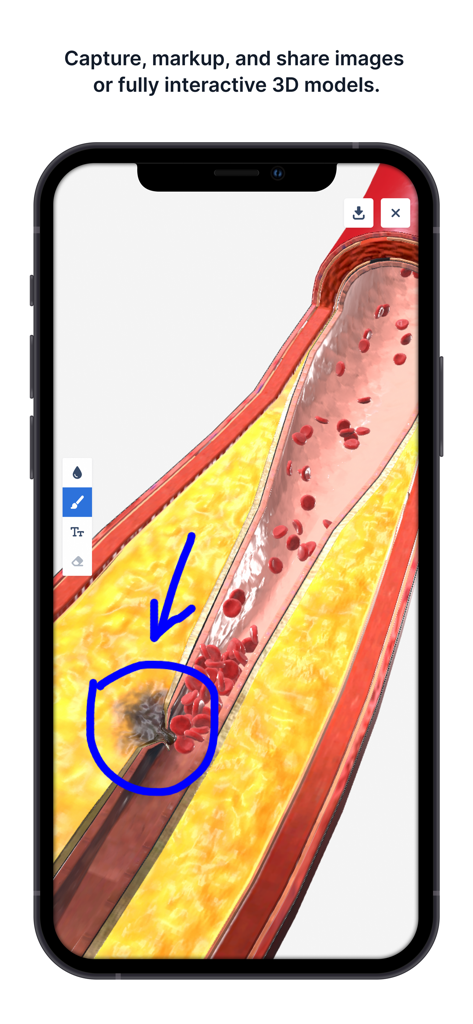3D human blood vessel cross-section with interactive blue markup in the BioDigital app