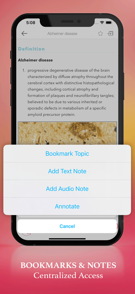 Dorland Pkt Medical Dictionary - Medical dictionary app interface for bookmarking and adding notes to clinical definitions.
