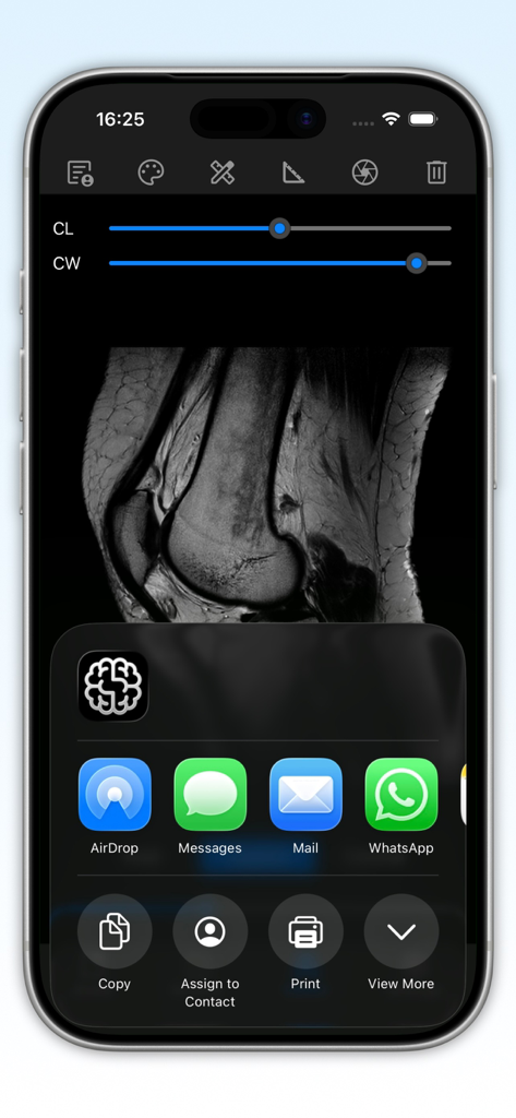 DICOM Studio Go - DICOM Studio Go app showing a knee MRI with sharing options on an iPhone