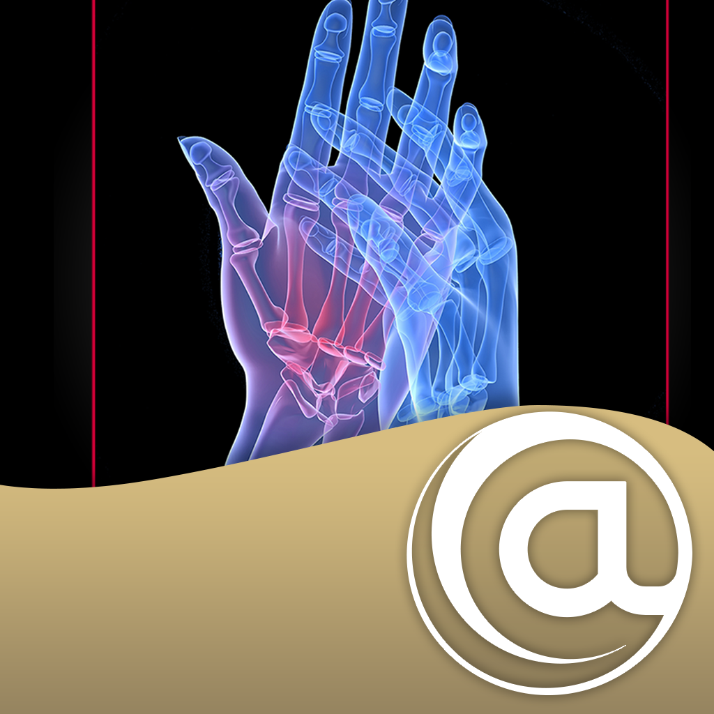 Rheumatoid Arthritis [RA] - Medical App | MWM