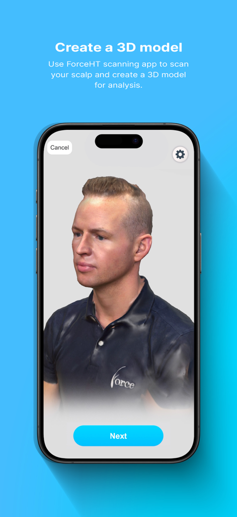 Une interface d'application mobile montrant un scan de modèle 3D de la tête d'un homme pour une consultation de greffe de cheveux.