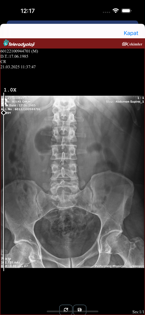 e-Nabiz mobile App zeigt ein Röntgenbild des Abdomens im Teleradiologie-Bereich an.