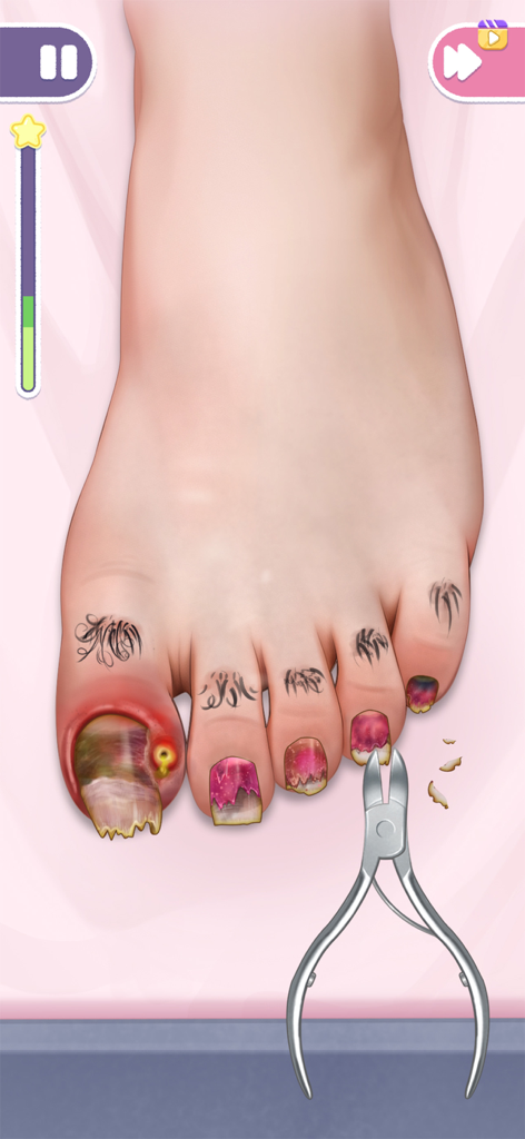 Pedicure mini game showing the treatment of an infected toenail with clippers
