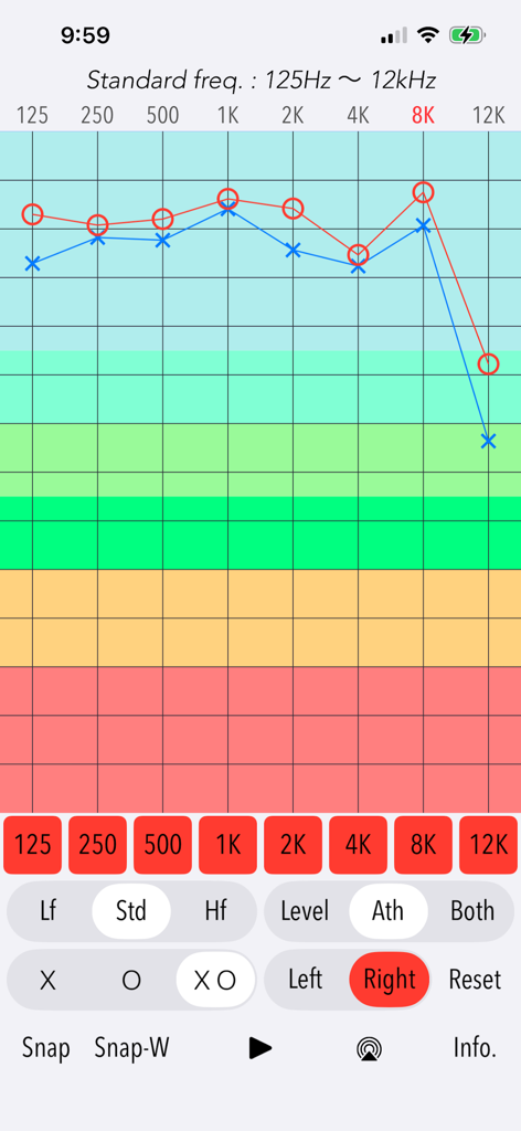 聴覚アナライザーポートレートアプリの標準周波数の聴力検査結果を示す周波数応答グラフ