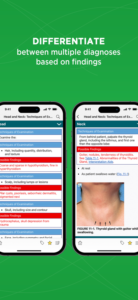 Bates' Pocket Guide - Bates Pocket Guide app interface showing clinical examination techniques and possible findings for medical students