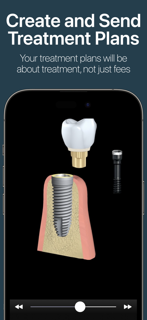 A 3D dental implant visual demonstration on a smartphone screen for patient treatment planning.