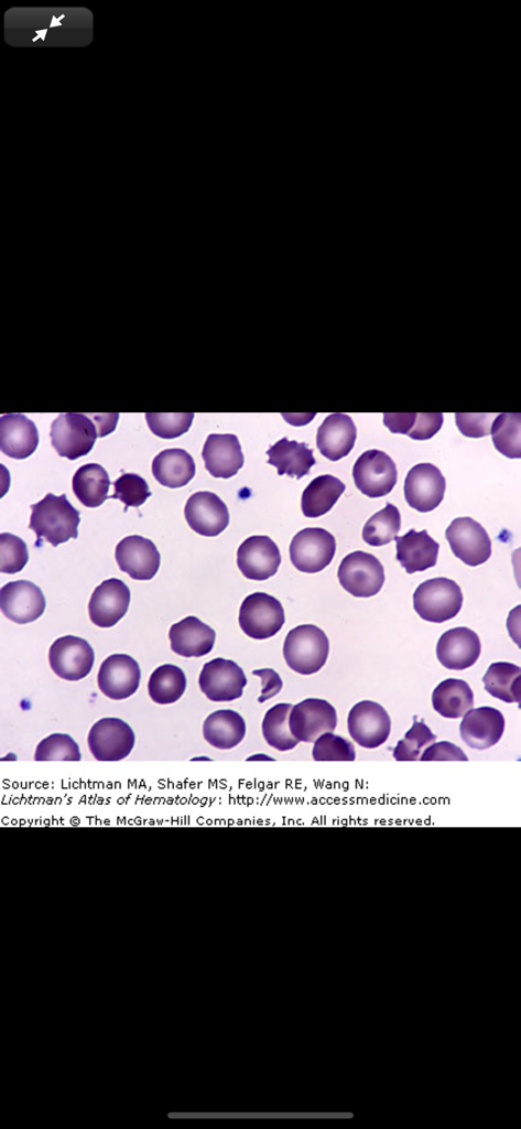 Microscopy view of blood cells in the Lichtmans Atlas of Hematology app