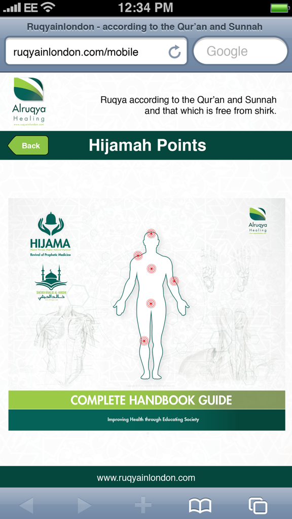 Un diagramma di un corpo umano che mostra i punti raccomandati per la coppettazione Hijama per la guarigione