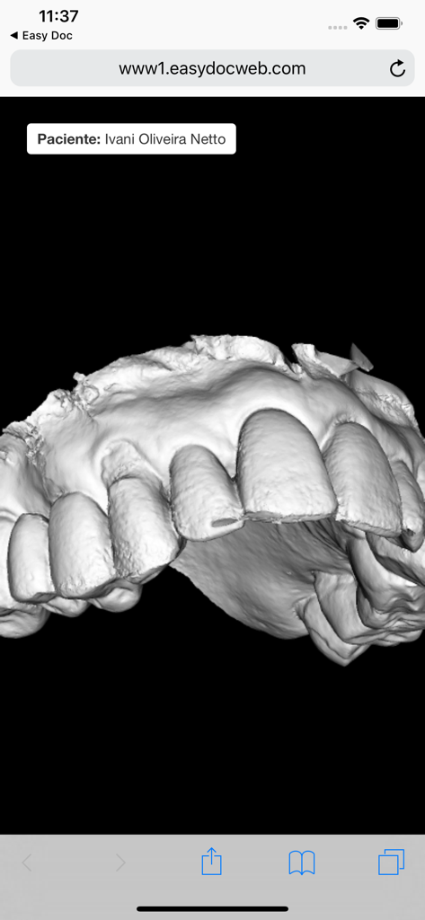 Easy Doc Anne Solutions - Scan radiologique dentaire 3D de dents de patient dans l'application Easy Doc