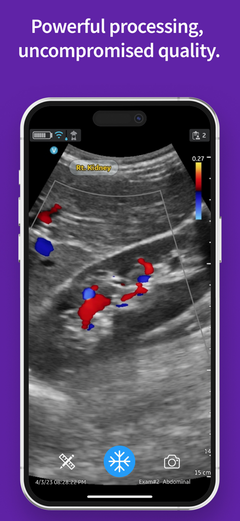 Imagem de ultrassom veterinário de alta resolução de um rim exibida em uma tela de smartphone com o aplicativo Vscan Air VET