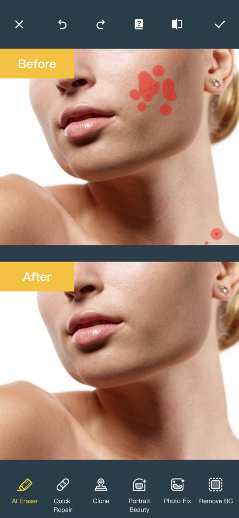 Comparación de antes y después de la eliminación de imperfecciones de la piel usando una aplicación de edición de fotos con IA