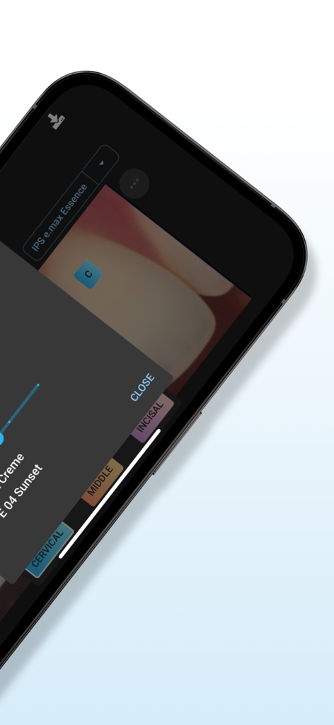 Matisse | Shade Matching - Matisse mobile app interface showing tooth shade zones and staining material selections for dental restorations