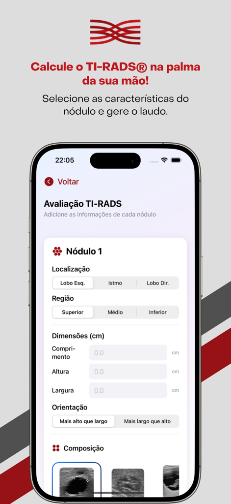 TI-RADS Calc - TI-RADS Calcアプリのインターフェース。場所や寸法などの甲状腺結節の特徴を入力します。