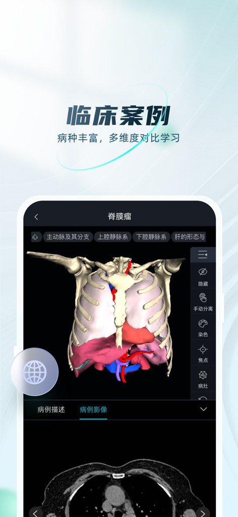 数字人解剖学STEM系统 - A 3D human thoracic model and CT scan in a clinical case study view