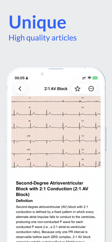 Die Benutzeroberfläche der EKG Atlas App zeigt einen hochwertigen Artikel und Streifen zur Diagnose eines 2:1 AV-Blocks.