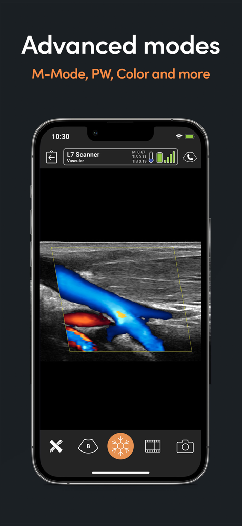 Clarius Ultrasound App - Smartphone screen displaying the Clarius Ultrasound App with an advanced color Doppler vascular scan