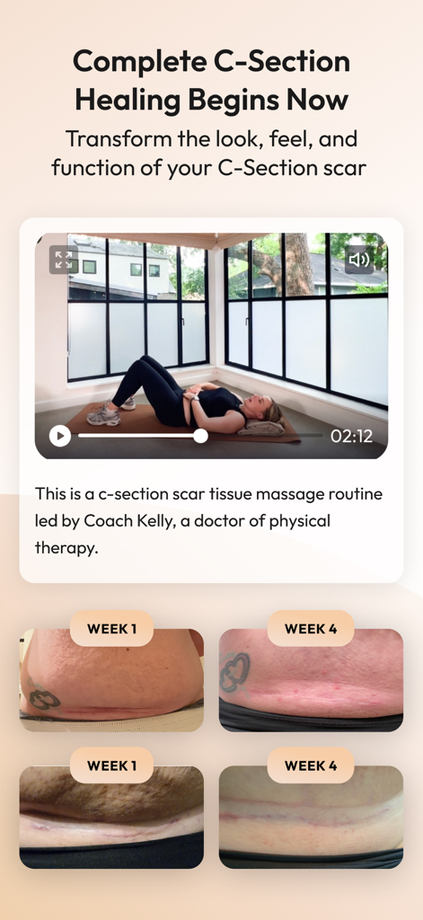 Natal - Pregnancy & Postpartum - C-Section scar healing progress and massage tutorial in the Natal app