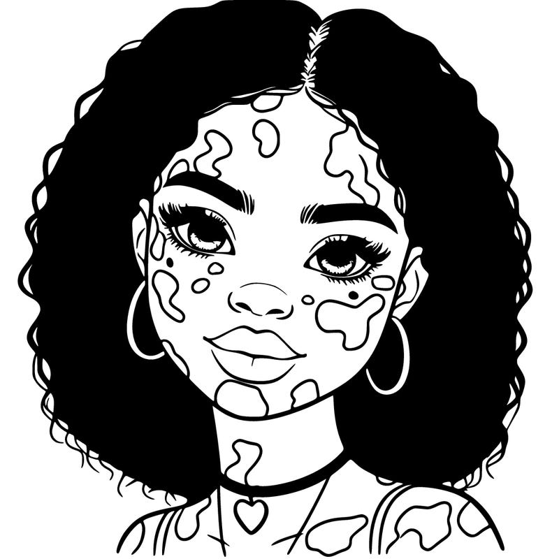 bleautiful black girl with vitiligo