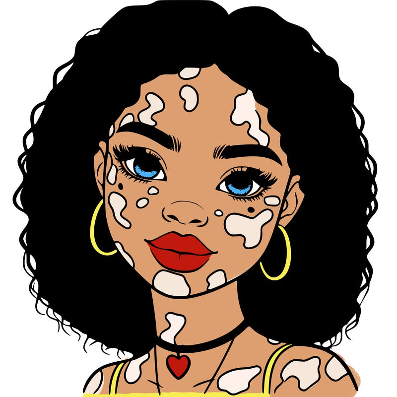 bleautiful black girl with vitiligo