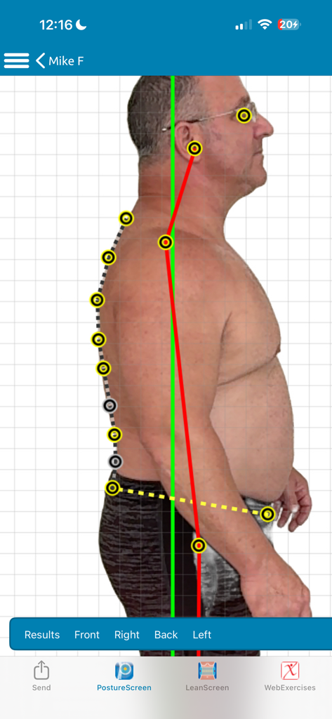 Side profile posture analysis scan using computer vision with anatomical markers and alignment lines