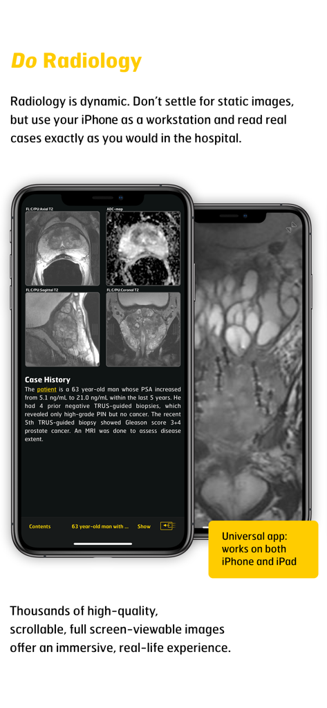 MR Imaging in Prostate Cancer - Prostate MRI imaging app interface showing clinical cases and radiology scans on an iPhone