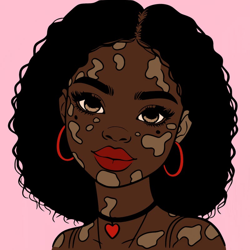 bleautiful black girl with vitiligo