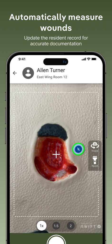 Interface do aplicativo móvel PointClickCare ChartPic mostrando uma ferida sendo medida automaticamente para documentação clínica.