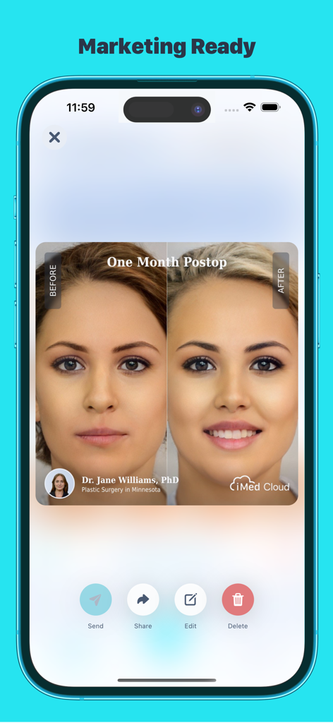 Un confronto professionale prima e dopo del viso con branding personalizzato nell'app iMed HIPAA cloud.