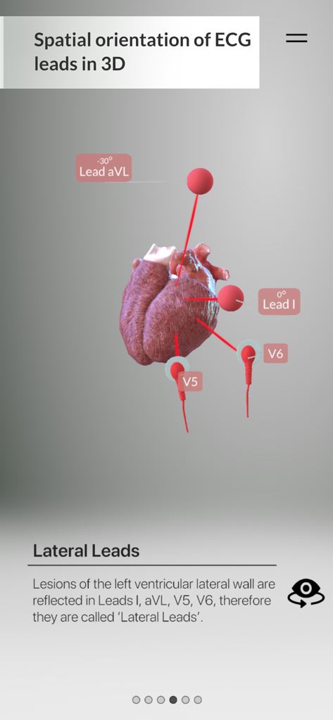 A 3D interactive visualization showing the spatial orientation of lateral ECG leads on a human heart model