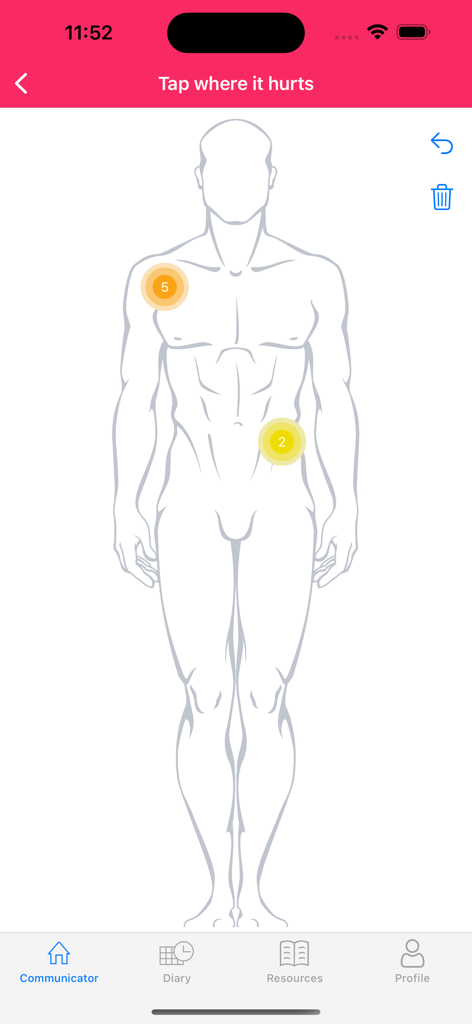 Un diagramma interattivo del corpo umano nell'app Comunicatore del Paziente utilizzato per identificare le posizioni del dolore e i livelli di gravità