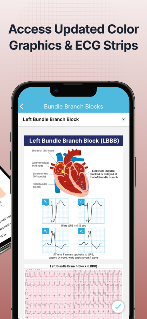 ECG EKG Interpretation Mastery - A mobile screen showing a heart diagram and ECG wave patterns for Left Bundle Branch Block interpretation.