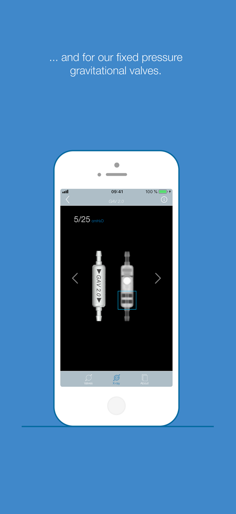 MIETHKE - Interface of the MIETHKE app showing technical details for the GAV 2.0 fixed pressure gravitational valve